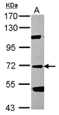 Anti-Factor XI antibody [N1N3] used in Western Blot (WB). GTX105974