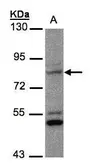 Anti-PHEX antibody [N1N3] used in Western Blot (WB). GTX105991