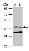 Anti-Pyruvate dehydrogenase kinase 1 / PDK1 antibody [N1C3] used in Western Blot (WB). GTX105999