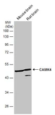Anti-CaMKIV antibody [N1C3] used in Western Blot (WB). GTX106023
