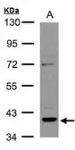 Anti-Rad51B antibody [N1C3] used in Western Blot (WB). GTX106045
