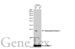 Anti-Adenylate kinase 1 antibody [N1C3] used in Western Blot (WB). GTX106079