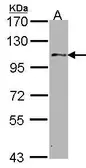 Anti-USP10 antibody [C2C3], C-term used in Western Blot (WB). GTX106092