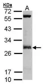 Anti-IDI1 antibody [N1C2] used in Western Blot (WB). GTX106100