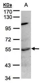 Anti-PTP1B antibody [N1N3] used in Western Blot (WB). GTX106104