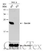 Anti-Sorcin antibody [N1C3] used in Western Blot (WB). GTX106105