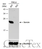 Anti-Sorcin antibody [N1C3] used in Western Blot (WB). GTX106105