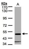 Anti-Glycine Receptor alpha 1 antibody [N1C1] used in Western Blot (WB). GTX106112