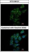 Anti-SIAT4A antibody used in Immunocytochemistry/ Immunofluorescence (ICC/IF). GTX106121