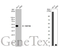Anti-SIAT4A antibody used in Western Blot (WB). GTX106121