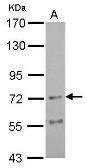 Anti-AChR alpha 4 antibody [N1N3] used in Western Blot (WB). GTX106127