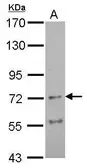 Anti-AChR alpha 4 antibody [N1N3] used in Western Blot (WB). GTX106127