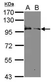 Anti-KEL antibody [N1N3] used in Western Blot (WB). GTX106130