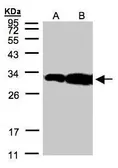 Anti-HOXC11 antibody [N1C2] used in Western Blot (WB). GTX106138