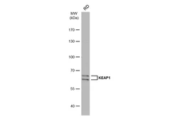 Anti-KEAP1 antibody [C1C3] used in Western Blot (WB). GTX106142