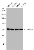 Anti-Hsp70 antibody used in Western Blot (WB). GTX106148