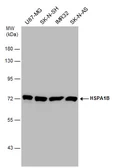 Anti-Hsp70 antibody used in Western Blot (WB). GTX106148