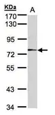 Anti-Meprin alpha antibody [N3C2], Internal used in Western Blot (WB). GTX106151