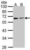Anti-Arylsulfatase A antibody [N2C2], Internal used in Western Blot (WB). GTX106155