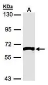 Anti-FRK antibody used in Western Blot (WB). GTX106156