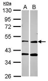 Anti-PPOX antibody [N3C3] used in Western Blot (WB). GTX106163