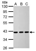Anti-Calponin 3 antibody used in Western Blot (WB). GTX106174