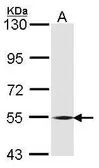 Anti-BMP6 antibody used in Western Blot (WB). GTX106182