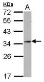 Anti-GSC antibody [N1C3] used in Western Blot (WB). GTX106191