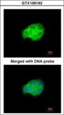 Anti-HSPA6 antibody [C1C3] used in Immunocytochemistry/ Immunofluorescence (ICC/IF). GTX106192