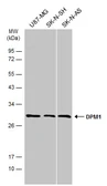 Anti-DPM1 antibody [N1C2] used in Western Blot (WB). GTX106196