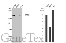 Anti-WNK1 antibody used in Western Blot (WB). GTX106197