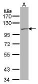 Anti-KCNQ5 antibody [N3C2], Internal used in Western Blot (WB). GTX106198
