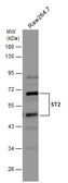 Anti-ST2 antibody [N1C1] used in Western Blot (WB). GTX106204