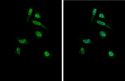 Anti-Gli1 antibody used in Immunocytochemistry/ Immunofluorescence (ICC/IF). GTX106207