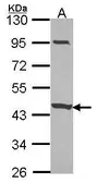 Anti-CCDC83 antibody used in Western Blot (WB). GTX106217