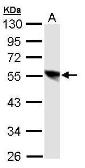 Anti-DP1 antibody [N1C1] used in Western Blot (WB). GTX106221