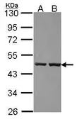 Anti-ZNF396 antibody [N1C2] used in Western Blot (WB). GTX106227