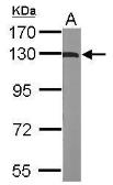 Anti-ACK1 antibody [N1N2], N-term used in Western Blot (WB). GTX106229