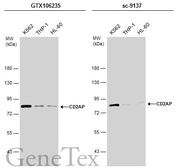 Anti-CD2AP antibody used in Western Blot (WB). GTX106235