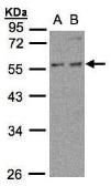 Anti-PFKFB4 antibody [N3C3] used in Western Blot (WB). GTX106237