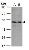 Anti-KIR3DL1 antibody used in Western Blot (WB). GTX106239