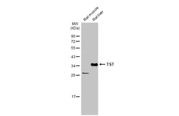 Anti-TST antibody used in Western Blot (WB). GTX106257