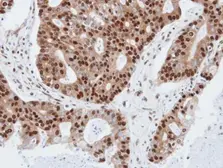 Anti-PDE4C antibody [N3C3] used in IHC (Paraffin sections) (IHC-P). GTX106268