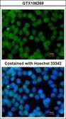 Anti-Flightless I antibody [N3C1], Internal used in Immunocytochemistry/ Immunofluorescence (ICC/IF). GTX106269
