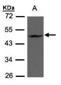 Anti-ZDHHC13 antibody [C3], C-term used in Western Blot (WB). GTX106273