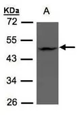 Anti-ZDHHC13 antibody [C3], C-term used in Western Blot (WB). GTX106273