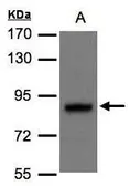 Anti-DISC1 antibody [N1], N-term used in Western Blot (WB). GTX106286