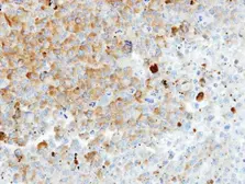 Anti-HIP55 antibody [N1], N-term used in IHC (Paraffin sections) (IHC-P). GTX106288