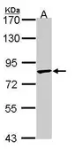 Anti-TRIM36 antibody [C3], C-term used in Western Blot (WB). GTX106290