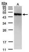 Anti-PIST antibody [C3], C-term used in Western Blot (WB). GTX106291